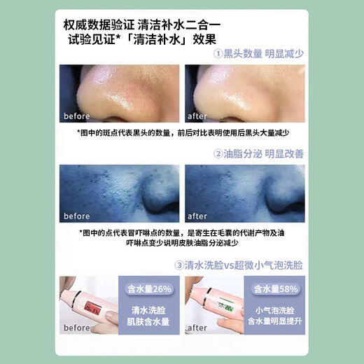 Wen Shiou small bubble beauty instrument facial cleansing instrument pore household oxygen injection blackhead removal instrument cleansing artifact hydrating instrument single-head model basic household blackhead absorption national standard