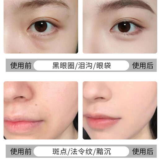 NARS concealer 6ml dark circles, acne marks, spots, redness, tear troughs, brightening non-stuck lines, small and medium size #Vanilla Vanilla Powder 6ml