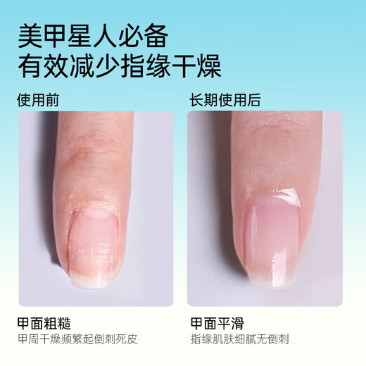 CandyMoyo Macadamia Nut Finger Oil Care Hand Essential Oil Moisturizing, Moisturizing, Diminishing Hand Wrinkles, Preventing Dry Cracks, Smoothing Barbs 9ml