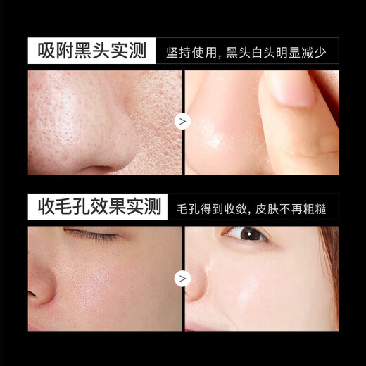 Eischrysanthemen-Bambuskohle entfernt Mitesser und verkleinert die Poren, dreiteiliges Set, reinigendes Mitesser-Nasenpflaster, Strohhalm, Schimmel, Nasenextraktionsflüssigkeit, T-Zonen-Pflege, eine Box