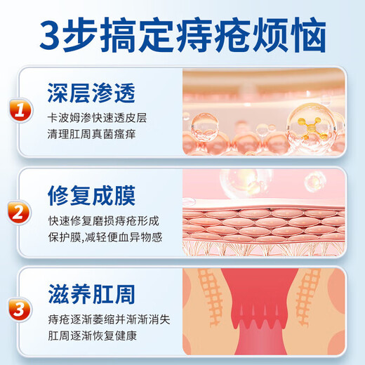 Tongrentang Hemorrhoids Cream removes flesh ball artifact internal hemorrhoids and external hemorrhoids mixed hemorrhoids, anal itching, swelling and pain, special ointment for blood in the stool 20g