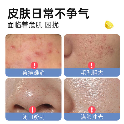 STRIDEX水杨酸棉片护理型+加强型粉刺黑头控油祛痘进口刷酸美国进口