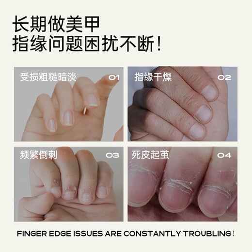 CandyMoyo Macadamia Nut Finger Oil Care Hand Essential Oil Moisturizing, Moisturizing, Diminishing Hand Wrinkles, Preventing Dry Cracks, Smoothing Barbs 9ml