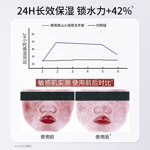 Kangaroo Mom Pregnant Women's Skin Care Products Alpine Edelweiss Cleansing Milk Set Repairs Redness and Sensitive Skin Special Birthday Gift