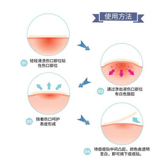 Oliveyoung Invisible Acne Patch 102+60 Patch to absorb pus, light and thin to remove acne and cover acne for men and women.