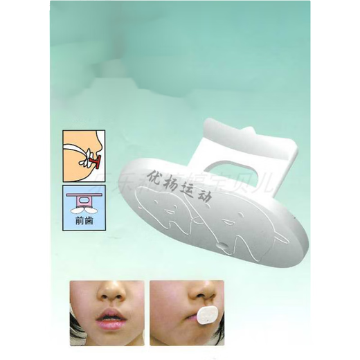 Powerful Japanese adults and children habitually mouth-breathing, short upper lip, labial muscle, protruding lip shape trainer, 10 pieces, 5 pieces in a pack + peach-shaped pendant, random colors