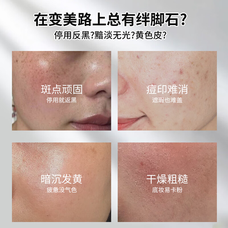 Su Xiuchen's L-VC essence freeze-dried tablets luminous tablets L-vitamin C non-medical moisturizing solid and liquid essence for New Year's Day