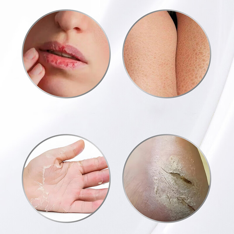 Haishi Hainuo Enjoy Vaseline Moisturizing Balm 100ml improves the skin of hands, feet and body, moisturizes dryness, cracks and prevents roughness