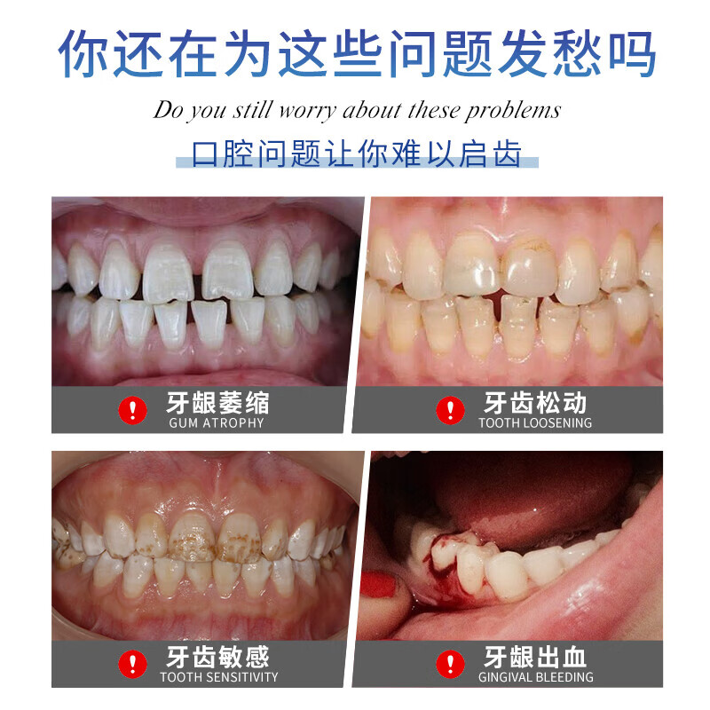 HIEUAILR German special toothpaste for gums, atrophy repair, regeneration, exposed tooth roots, gum protection, tooth fixation, desensitization, top ten well-known brands