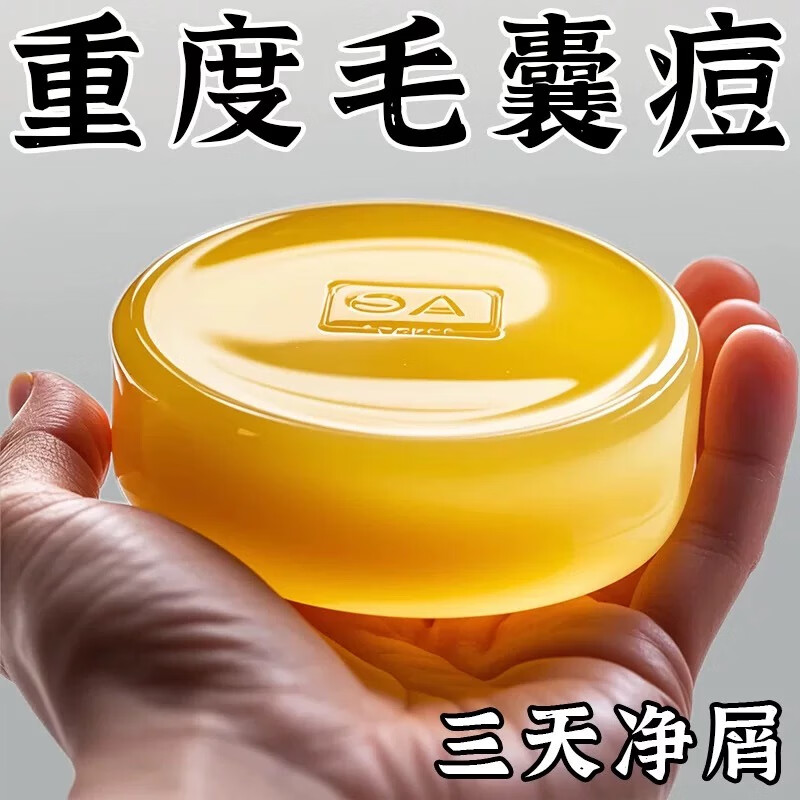 Dr. Shi Hong Kong genuine Mao Yanning shampoo soap purifies inflammation, repairs hair follicles, removes dandruff, relieves itching, removes mites, and controls oil. Buy 1 hair of 3. Head mites/itching/dandruff.