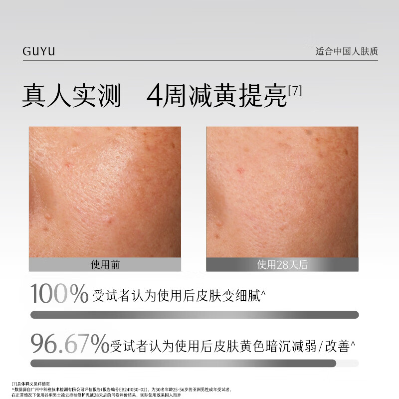 Guyu men's oil control lotion 60ml oil control, acne removal, light mark repair, moisturizing cosmetics