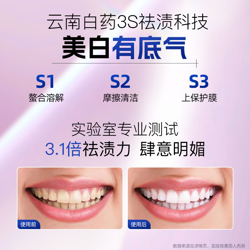 Yunnan Baiyao's new pump-type toothpaste removes yellowing, removes stains, whitens, refreshes and improves tooth stains 100g + mouth guard after smoking 100g