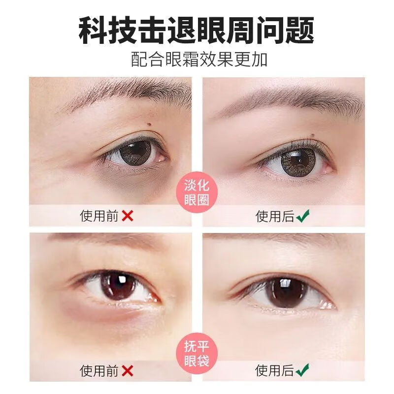 Buy one, get four free, electric eye massager, massager to remove eye bags, fine lines, wrinkles, dark circles, facial lifting eye pencil 520, birthday gift for boyfriend and girlfriend, ivory white, free 4 massage heads, vibration massage (batteries not included)