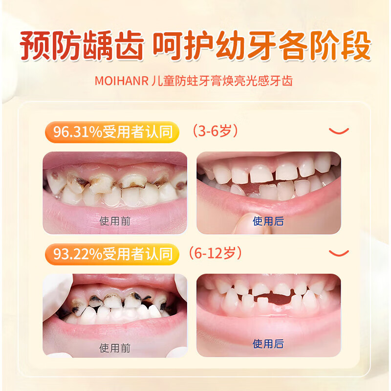 MOIHANR German brand children's toothpaste 3-6-12 years old, anti-cavity containing fluoride, anti-cavities, stain removal, special for tooth replacement period