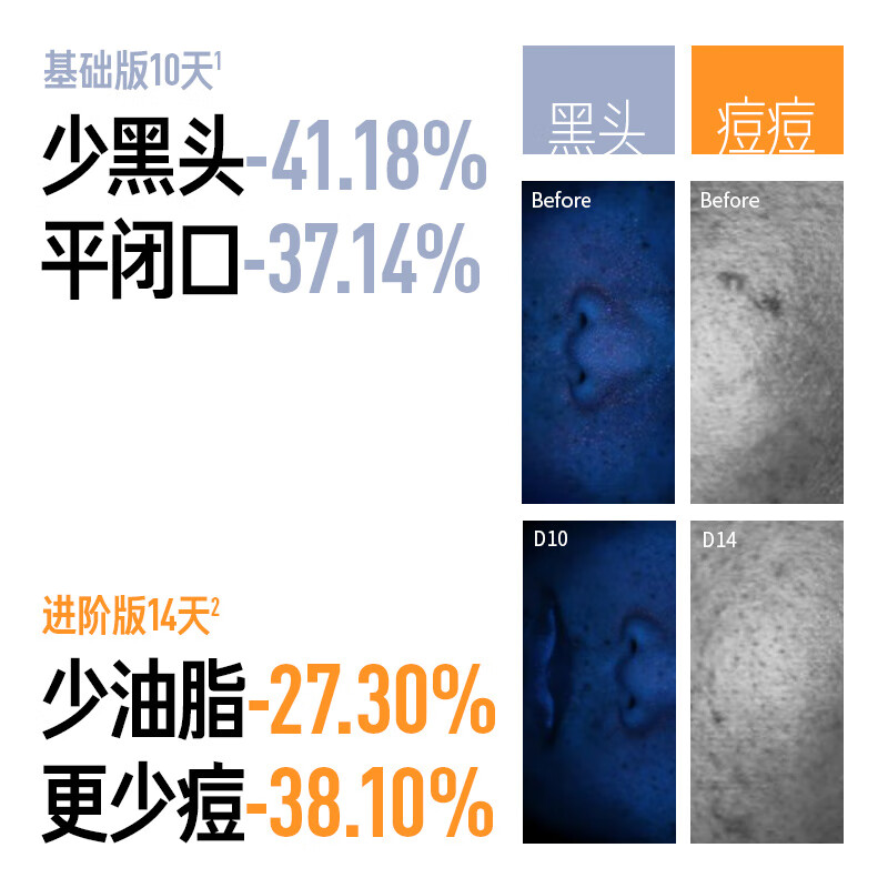 Life's Research Salicylic Acid Jelly Mask 100g Cleansing Mask Fruit Acid Mud Mask Removes Acne, Removes Blackheads, Acne Skin, Improves Closed Mouth Valentine's Day