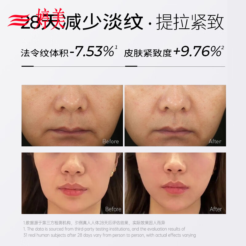 Tingmei (GRACWELL) face slimming bandage anti-gravity double chin tightening full face lifting and firming nasolabial folds anti-sagging face sculpting face slimming