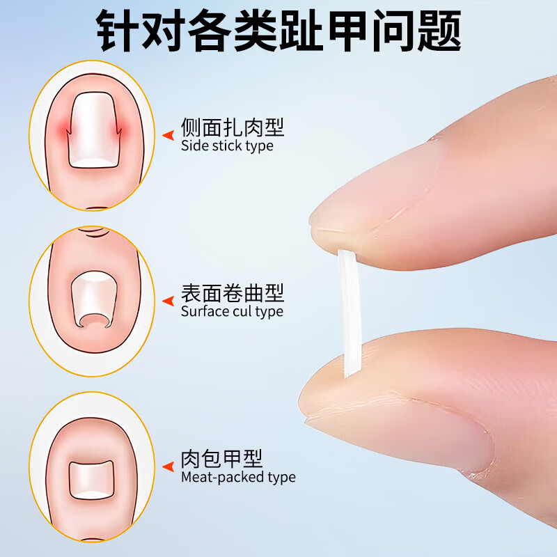 Jebis paronychia correction toenail correction corrector isolation filling pad toenail long in the flesh trimming artifact
