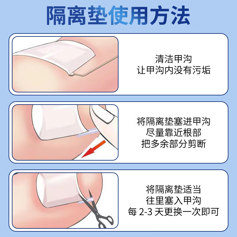 Jebis paronychia correction toenail correction corrector isolation filling pad toenail long in the flesh trimming artifact