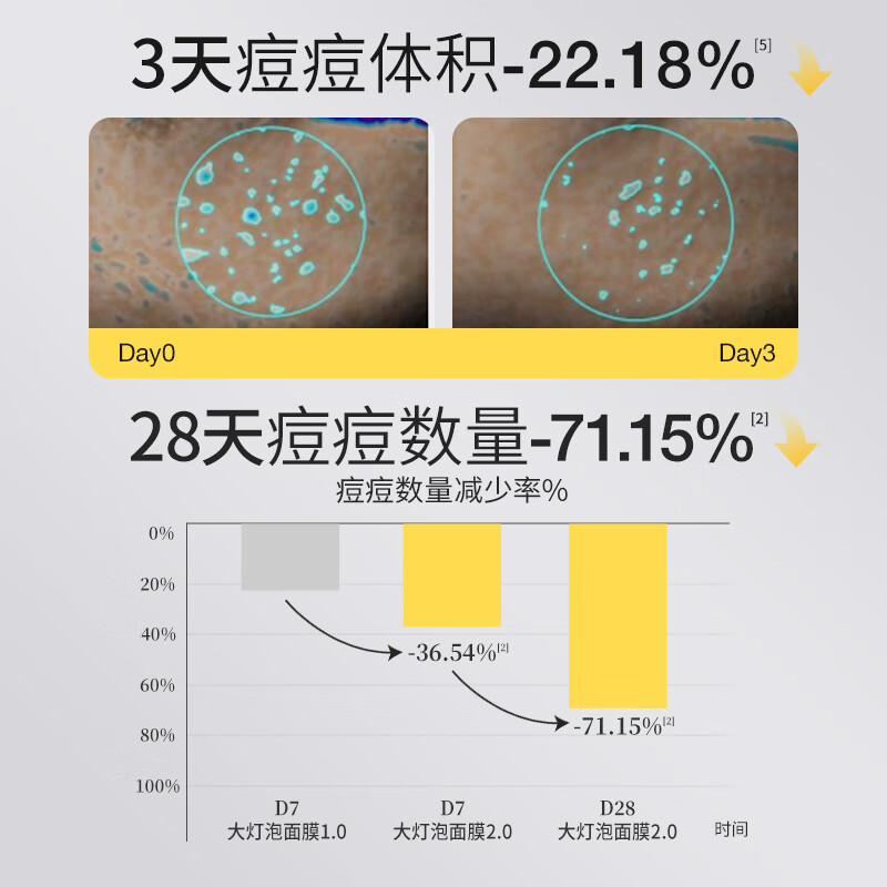 Yusu Big Bulb Anti-Acne Mask, recommended by Chen Meng, hydrating and moisturizing essence, soothing and repairing acne-prone skin mask for men and women