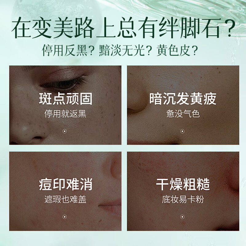 BEAUTY NOTES L-vc Essence Tablets Lyophilized Tablets Luminous Tablets Vitamin C Improves Dullness and Brightens Skin New Year's Gift 5 Boxes