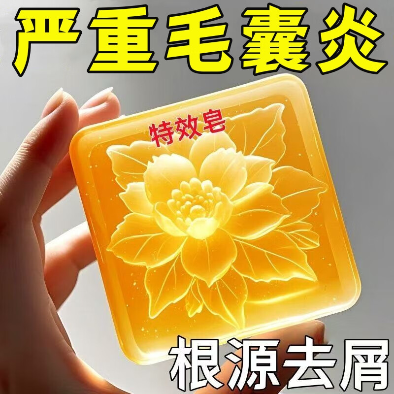 Dr. Shi Hong Kong genuine Mao Yanning shampoo soap purifies inflammation, repairs hair follicles, removes dandruff, relieves itching, removes mites, and controls oil. Buy 1 hair of 3. Head mites/itching/dandruff.