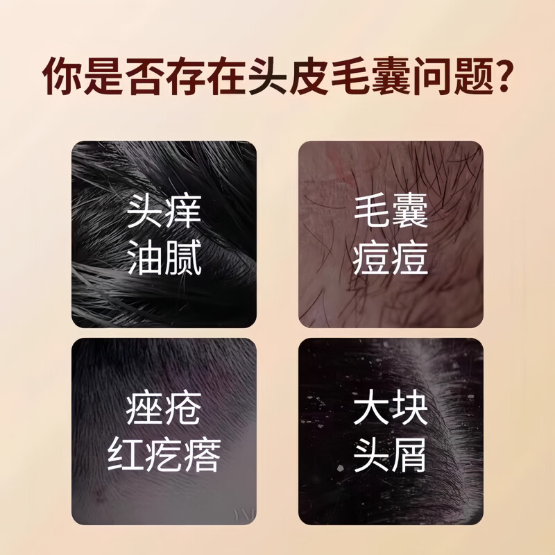 Chuangmeidai coal tar shampoo lotion official flagship hair follicle seborrheic scalp anti-dandruff anti-itching water dew oil control inflammation