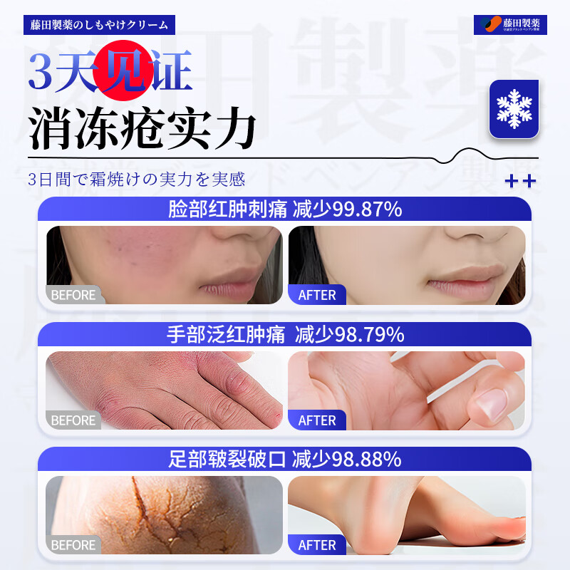 Fujita Pharmaceutical Chilblain Cream Anti-itch Frostbite Cream Medical Ear Face Finger Cracked Frostbite Swelling Antifreeze Children Adults 1 Box