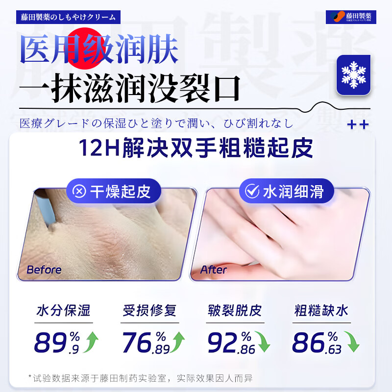 Fujita Pharmaceutical Chilblain Cream Anti-itch Frostbite Cream Medical Ear Face Finger Cracked Frostbite Swelling Antifreeze Children Adults 1 Box