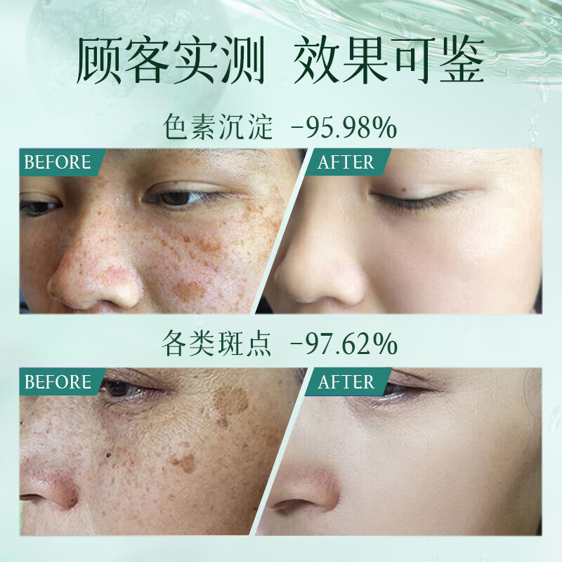 BEAUTY NOTES L-vc Essence Tablets Lyophilized Tablets Luminous Tablets Vitamin C Improves Dullness and Brightens Skin New Year's Gift 5 Boxes