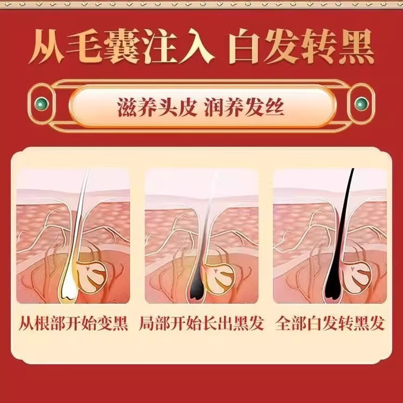 Domestic genuine Xinjiang Usman grass shampoo soap handmade white hair black hair nourishing heavy plant essence soap concentration essence 999 severe white hair completely black without turning white