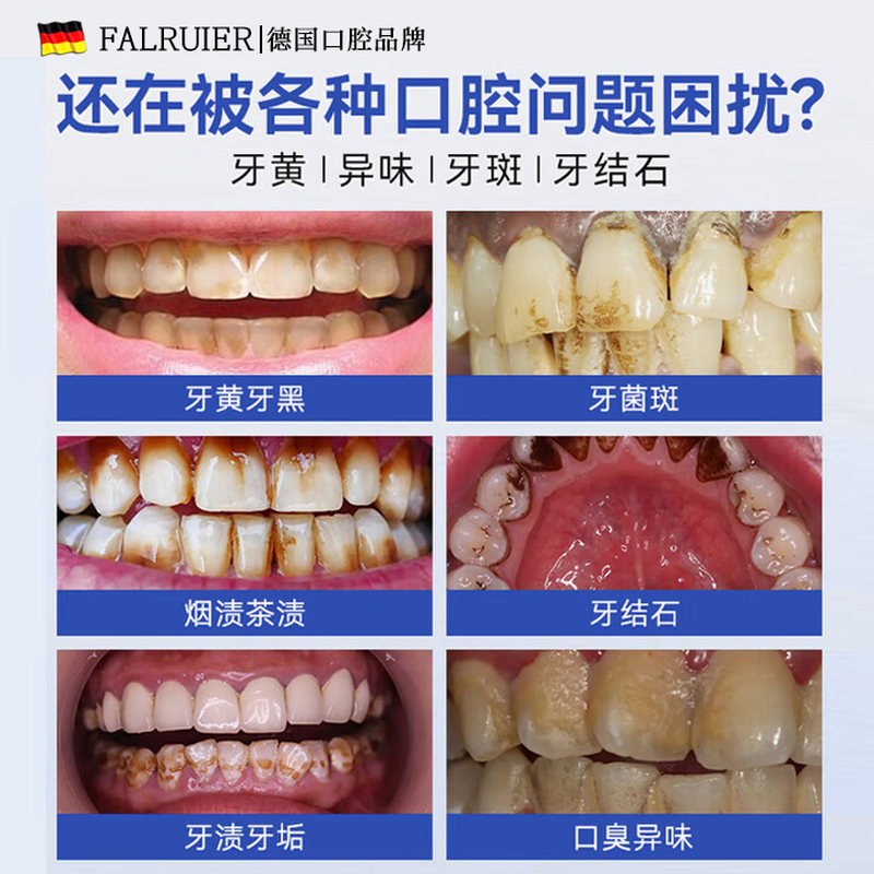 FALRUIER German whitening toothpaste removes yellow, removes smoke stains, whitens, inhibits bacteria, removes bad breath, freshens breath, tartar, and is No. 1 on the gold list