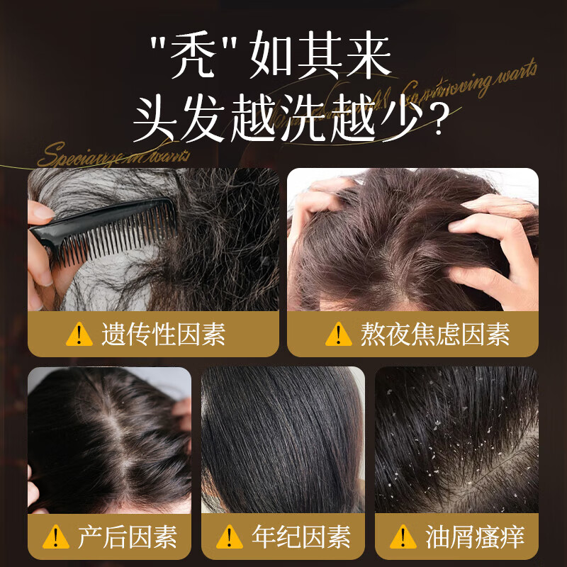 Fanyongchen selenium disulfide anti-dandruff shampoo vitamin B5 anti-itch oil control long-lasting fluffy shampoo for men and women