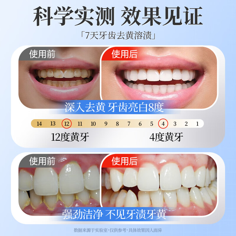 Yingfeng International Whitening Toothpaste removes yellowing, removes bad breath, brightens teeth stains, smoke stains, tartar and stones, whitens, inhibits bacteria and removes bad breath. The first one on the gold list.
