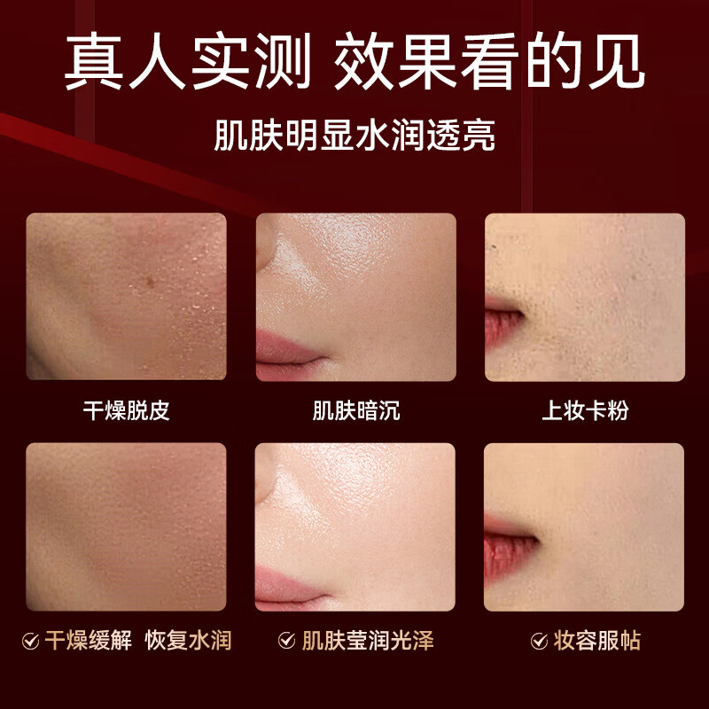 OES Oxygen Injection Instrument Hydration Instrument Humidification Artifact Atomizer Sprayer Water Light Instrument Beauty Instrument Hydrating Whitening Portable Household Facial Steamer Facial Handheld Gift for Girls Luxury Model 4 Times Penetration + Efficient Absorption + Water Light Technology + Essence Gift Pack Red