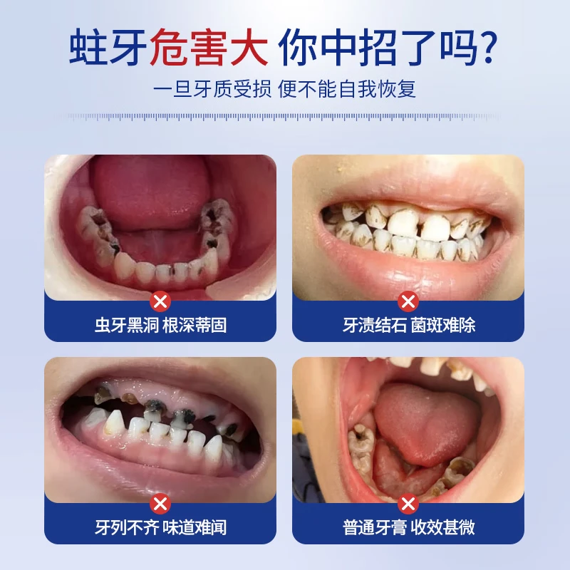 Children's toothpaste 3-12 years old containing fluoride and anti-moth children's Ora fluoride toothpaste gum care remove stains fresh breath two sticks