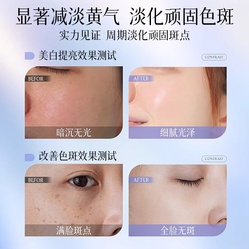 Micaoji 377 water emulsion skin care products, hydrating, whitening, lightening, brightening, anti-wrinkle and firming, New Year's Day gifts for men and women