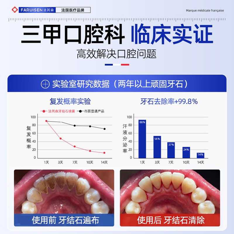 Faresen dental calculus spray dissolves tartar, removes yellow breath, smoke stains, whitens and sterilizes mouthwash toothpaste powder JD.com self-operated