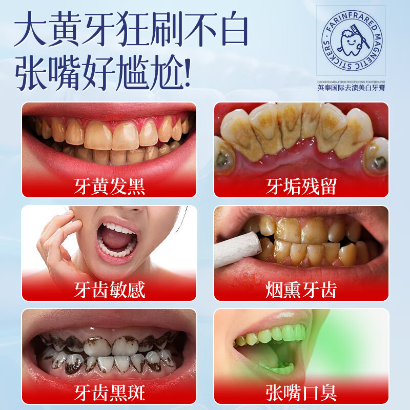Yingfeng International Whitening Toothpaste removes yellowing, removes bad breath, brightens teeth stains, smoke stains, tartar and stones, whitens, inhibits bacteria and removes bad breath. The first one on the gold list.
