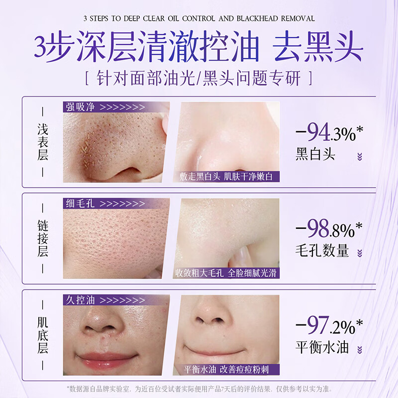 Qingzitang Azelaic Acid Perilla Cleansing Mud Mask Deep Cleansing Blackhead Removal Shrink Pores Acne Closed Mouth Acne Removal Mask 100g