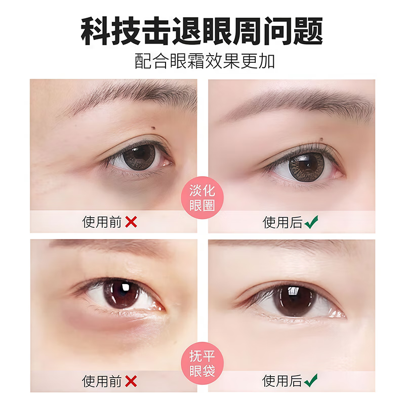 Electric Eye Massager Massager Removes Eye Bags, Fine Lines, Dark Circles, Facial Lifting and Beauty Eye Pen 520 as a birthday gift for boyfriend and girlfriend, Ivory White, 4 free massage heads, Vibration Massage (batteries not included)