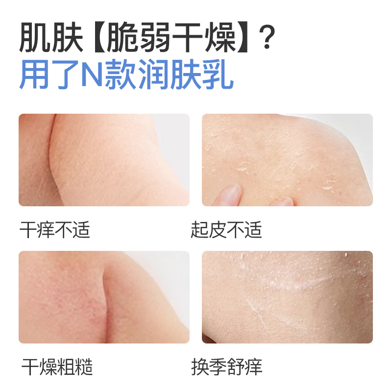 Sakose Vaseline Calendula Anti-itch Moisturizer 500g Autumn and Winter Moisturizing Soothing Mild Anti-Dry Skin Itchy Body Lotion