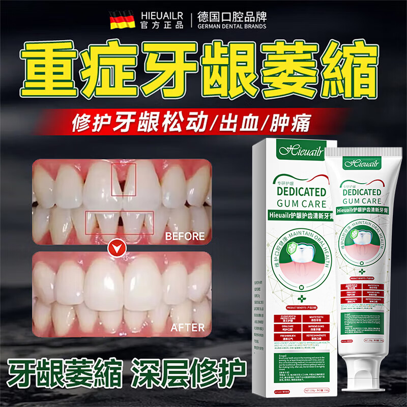 HIEUAILR German special toothpaste for gums, atrophy repair, regeneration, exposed tooth roots, gum protection, tooth fixation, desensitization, top ten well-known brands