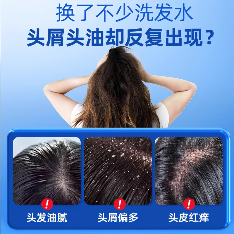 Chuangmeidai coal tar shampoo lotion official flagship hair follicle seborrheic scalp anti-dandruff anti-itching water dew oil control inflammation
