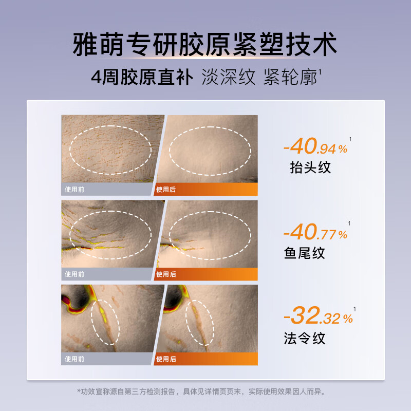 Yameng Golden V-Face Instrument LIFT Beauty Instrument New Year's Gift Facial Massager Firming Jawline Lifting and Lightening Lines Birthday Gifts for Girls and Girlfriends Exclusive for Live Broadcast LIFT Golden V-Face Instrument + Oxygen Injection Instrument Combination