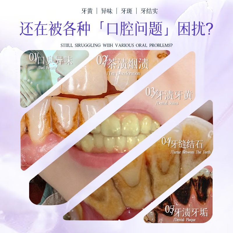 Layanana Australian lysozyme whitening toothpaste removes bad breath, removes yellowing, removes tooth stains, removes tobacco stains and tartar Popular Products Gold List Five Pack