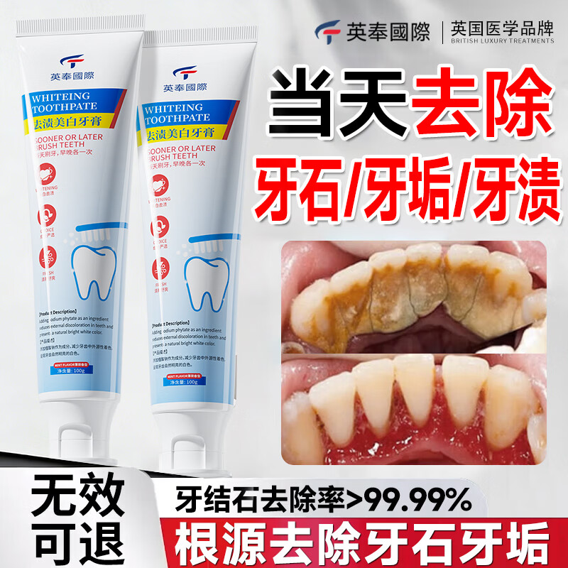 Yingfeng International Whitening Toothpaste removes yellowing, removes bad breath, brightens teeth stains, smoke stains, tartar and stones, whitens, inhibits bacteria and removes bad breath. The first one on the gold list.