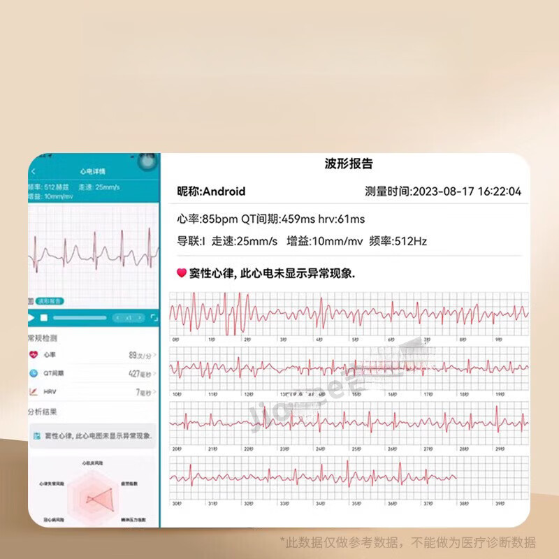 Other new medical-grade smart blood pressure watches for the elderly, Bluetooth calls, blood lipids, uric acid, heart rate, electrocardiogram monitoring, basic version ECG electrocardiogram + heart rate + HRV + blood oxygen + sleep + blood sugar + blood pressure + body