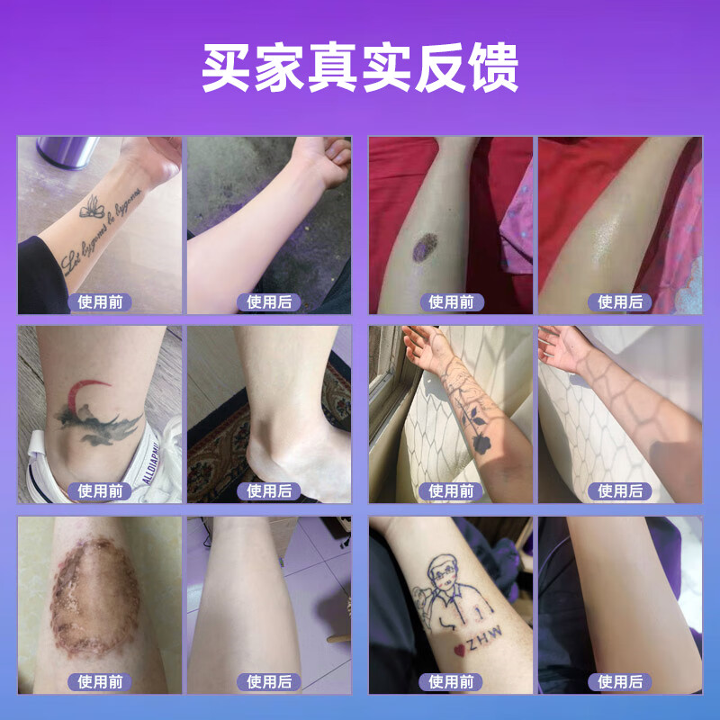 Yizheer Concealer Tattoo Covering Sticker Invisible Covering Spots, Birthmarks, White Spots, Acne Prints, Flesh-colored Waterproof, Sweat-proof and Anti-rubbing Special Yizheer 4.0 Professional Tattoo Covering Liquid Set