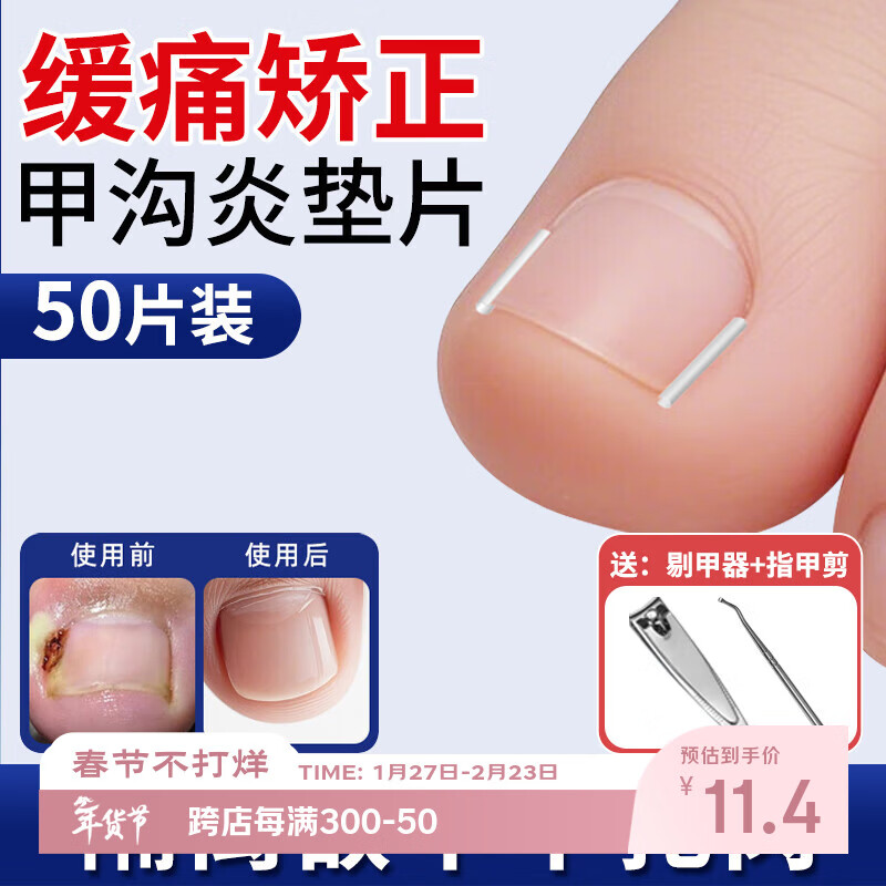 Jebis paronychia correction toenail correction corrector isolation filling pad toenail long in the flesh trimming artifact