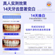 Warronson teeth patch whitening teeth yellowing tool patch to remove bad breath and turn blemish white teeth film periodontal care stain removal enzyme
